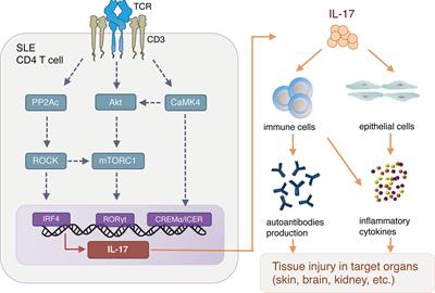 Current Insights and Future Prospects for Targeting IL-17 to Treat Patients With Systemic Lupus Erythematosus